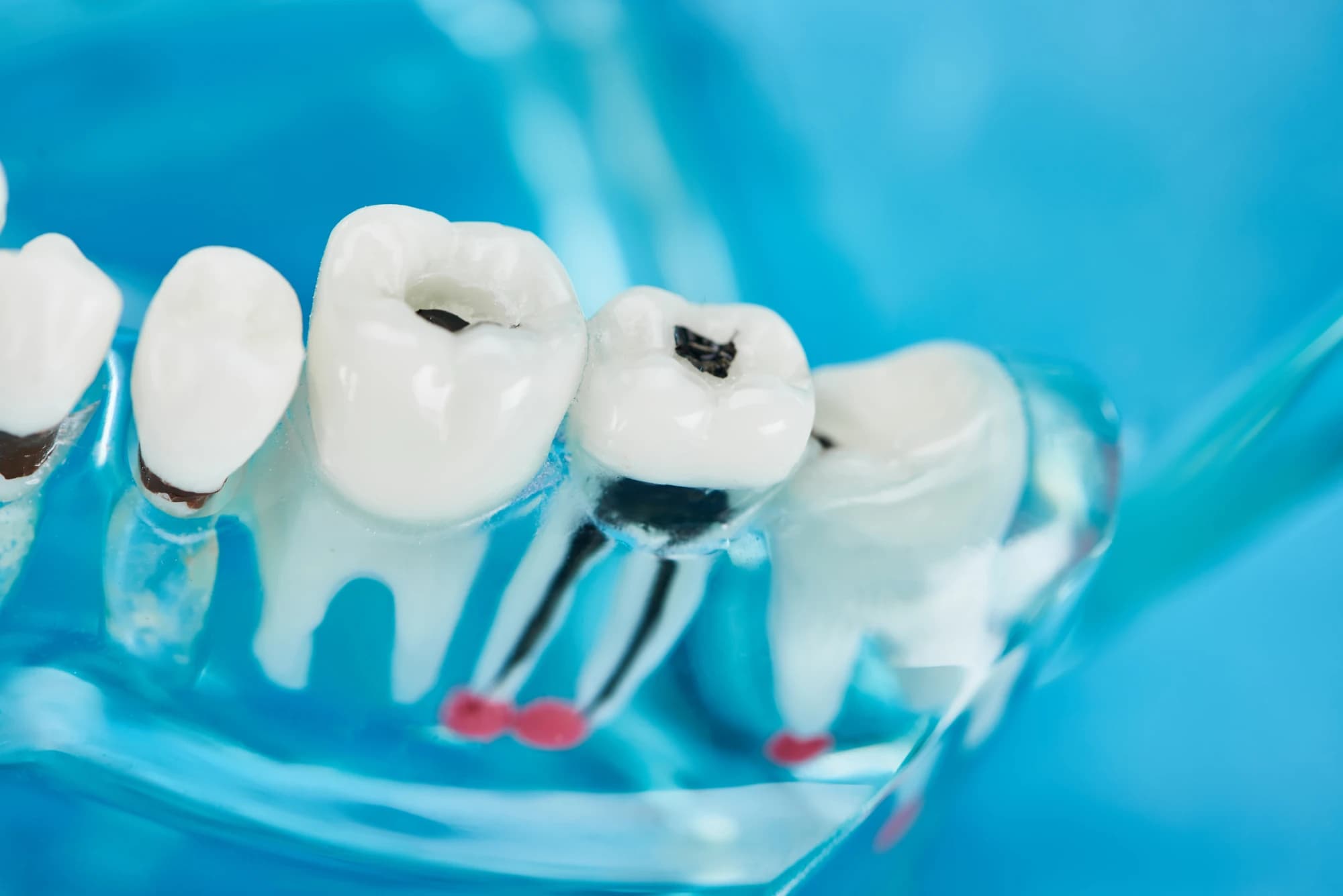Comfortable Dentistry